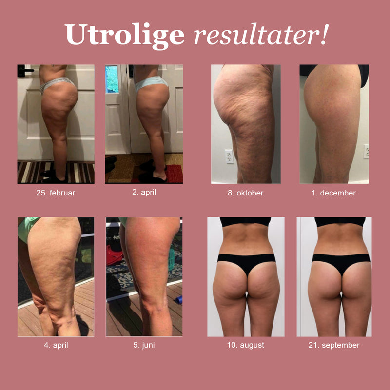 Før- og efterbillede med rosa LUMIVE-leggings